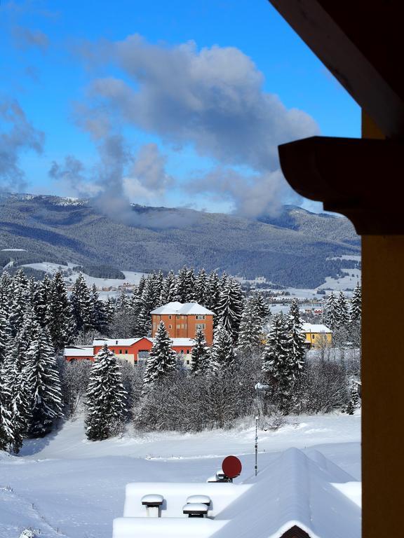 Hotel Belvedere Roana Exteriör bild
